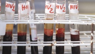 Aids, un'iniezione due volte all'anno può prevenire l'Hiv