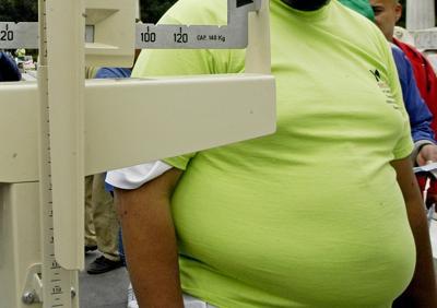 Altro che dottor Nowzaradan, contro l'obesità l'innovazione parla italiano