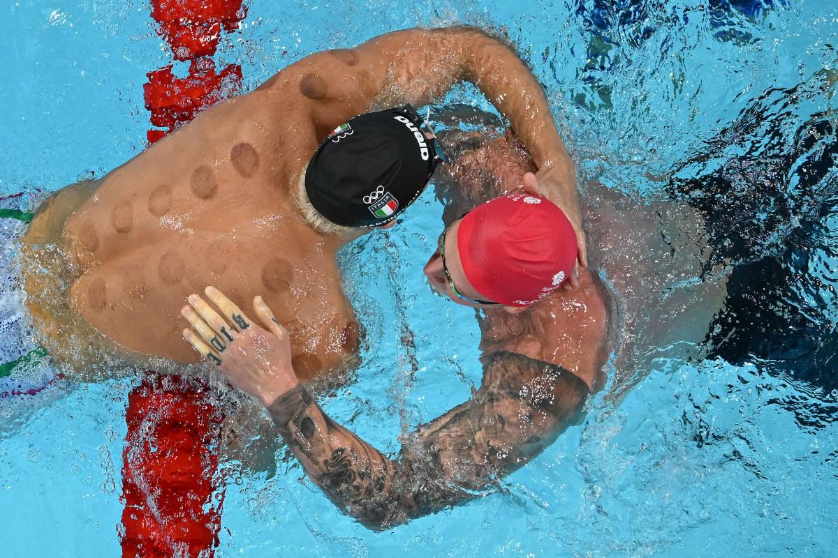 Coppettazione aiuta nel nuoto alle Olimpiadi 2024? I medici: "Non ha basi scientifiche"