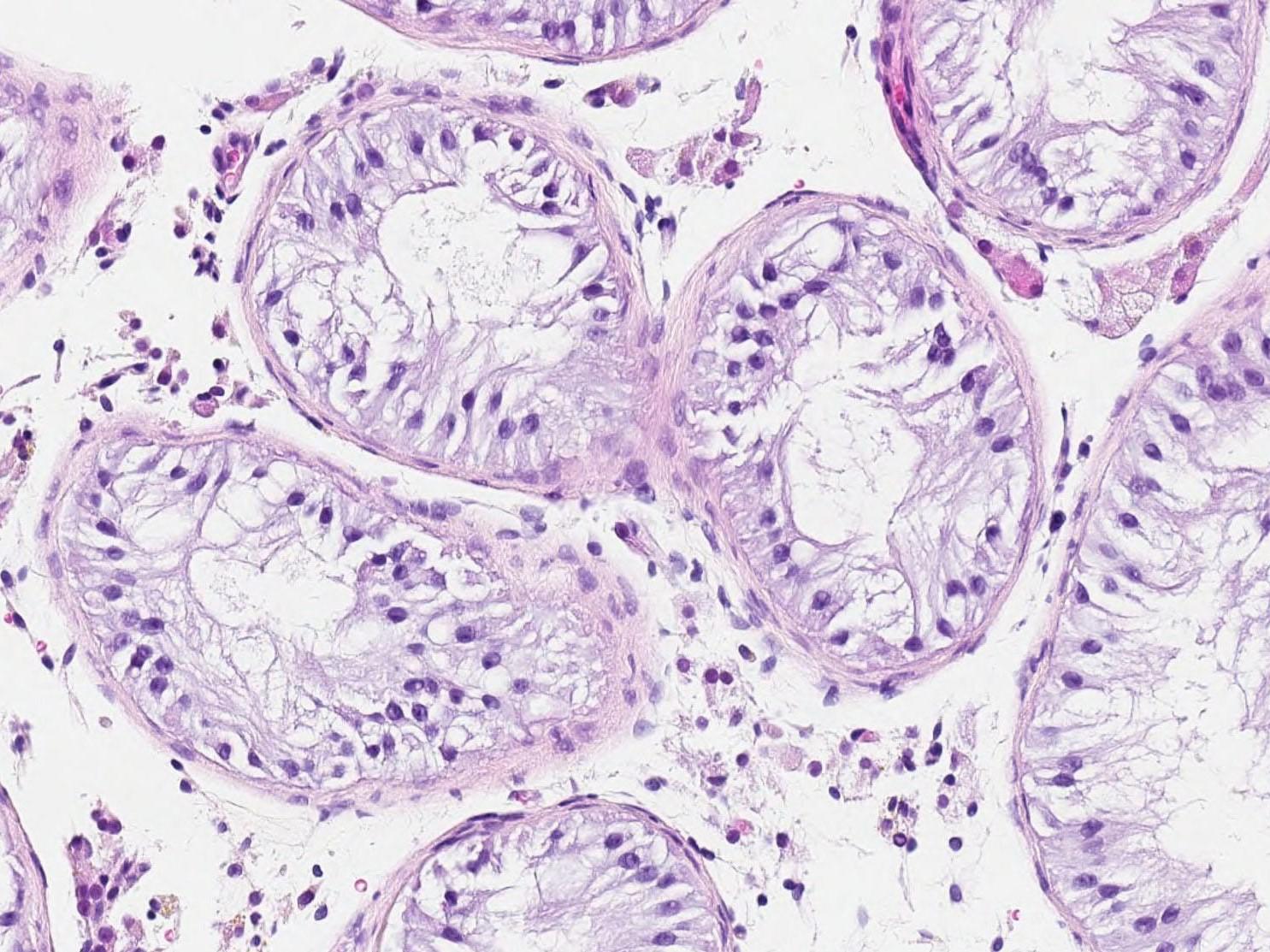 Nobel Medicina, il premio ai microRna: evidenziatori nel manuale d'istruzioni delle cellule